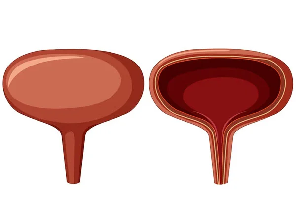 Bladder Augmentation