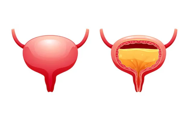 Bladder Repair