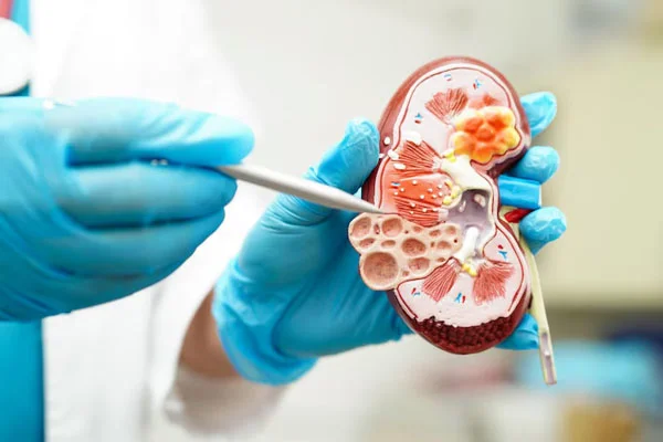 Bladder Stone Surgery