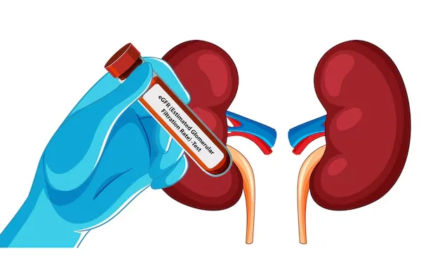 Kidney Transplantation
